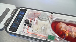 LifePort Liver Transporter | Transforming Preservation