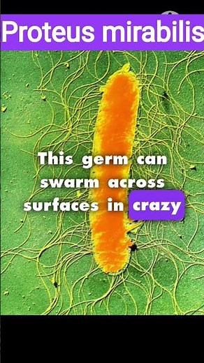 The Sneaky Bacterium – Proteus mirabilis! 🦠" #ScienceFacts #Microbiology