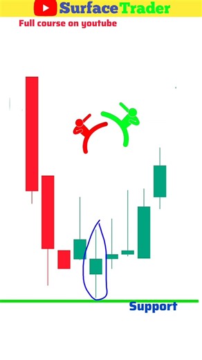 Why Most Traders Fail at Chart Reading (Candlestick Analysis) #chartanalysis #trading