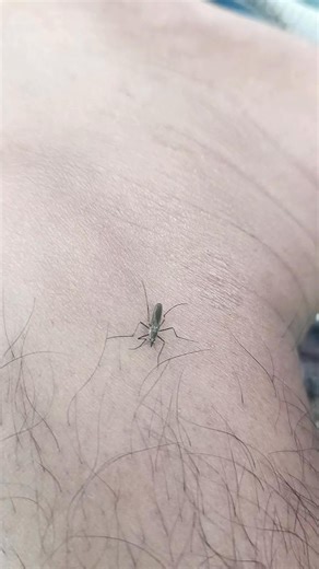 when a mosquito bites my leg it won't escape from my scissors ✂✂ 🔥🦟 #mosquito #mosquitokiller #insec #amazing | Jamaludin Arifai