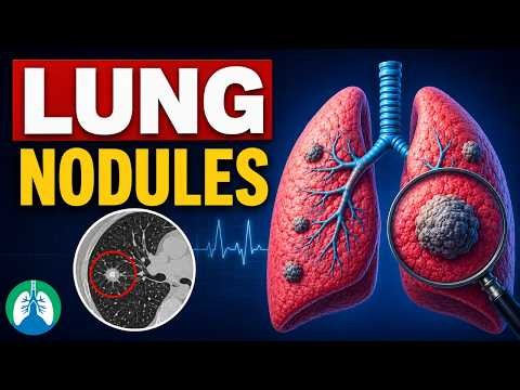 Lung Nodules | Diagnosis, Causes, Symptoms, and Treatment