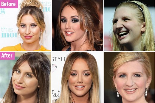 Here's a few of the best (and worst) celeb nose jobs in the business