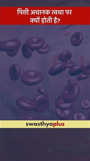 पित्ती अचानक त्वचा पर क्यों होती है? | What are the causes of Hives? | Dr Ruchika Singh | #Shorts
