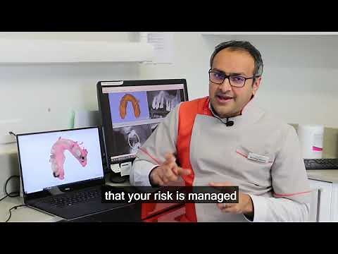 Is There Any Side Effects of Dental Implants? || Side Effects of Dental Implants EXPLAINED!!