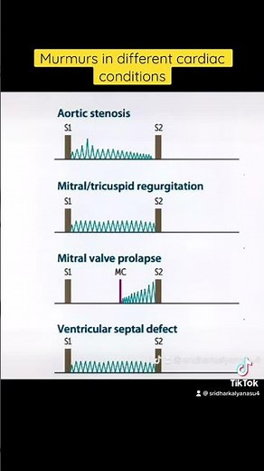 Murmurs in different cardiac conditions #murmurs #cardiacmurmurs #heartdisease