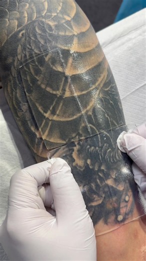 Erase the Ink, Keep the Confidence: Professional Laser Tattoo Removal ………………………………. #LaserTattooRemoval #InkRemoval #TattooErase #ClearSkinJourney #LaserTreatment