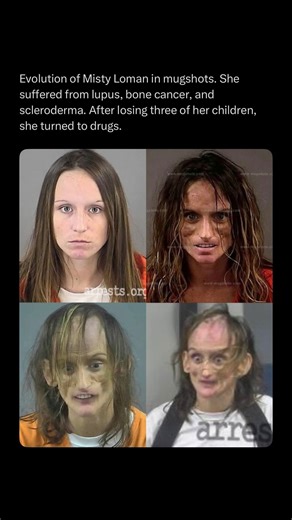 Horrors | Misty Loman’s series of mugshots went viral online, often used as a cruel example of drug addiction’s toll — but her story was far more... | Instagram