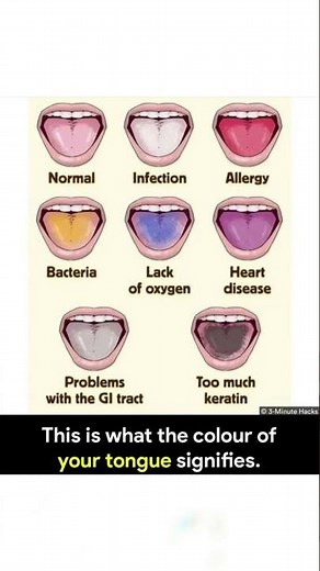 What Your Tongue Color Tells You About Your Health