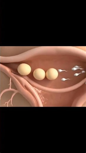 Triplet babies inside view of the mother #anatomy #healthylifestyle #teamhamza