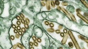 Trump administration cancels $766 million Moderna contract to fight future pandemics, including bird flu