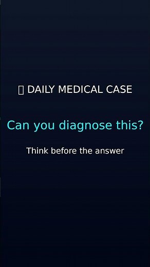 🩺 Melanoma & Skin Cancer: Melanoma Staging & Management