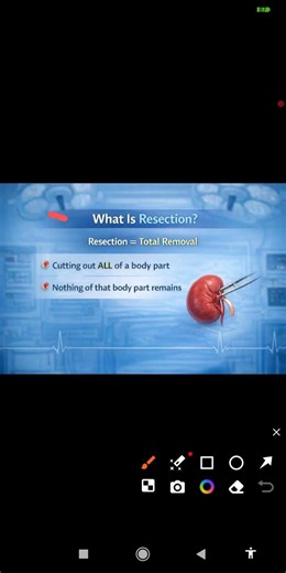 Excision & incision #medicalcoding #cpc #coder #coding