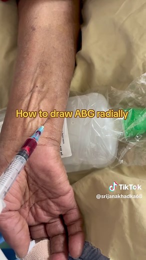Step-by-Step Guide to Drawing ABG Radially