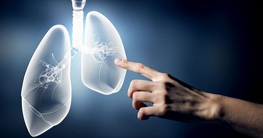 Pulmonary Hypertension | Family Doctor