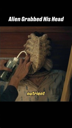 An Facehugger Grabbed His Head