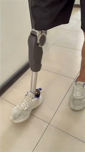 Getting Ready to Move | Setting Up an Artificial Leg #ProstheticLife #DailyRoutine. #inspiration
