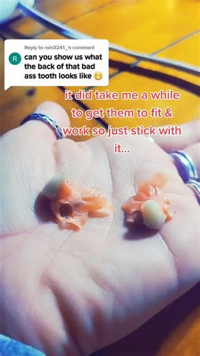 DIY Dentures: How to Create Comfortable Partial Teeth