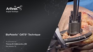 BioPatella™ OATS® Technique