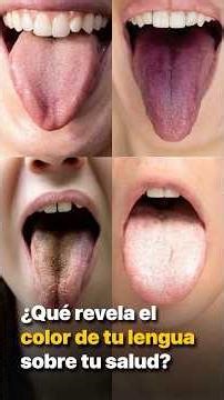 ¿Qué revela el color de tu lengua sobre tu salud?. ‪@KrystianVazquez‬