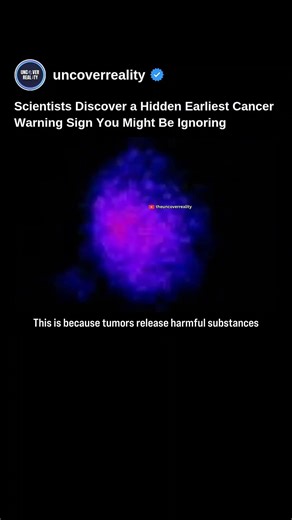 Scientists Discover A Hidden Earliest Cancer Warning Sign That You Might Be Ignoring #shorts