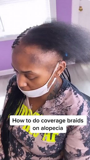 Cover Up Bald Spots with Knotless Braids: Hairstyles for Alopecia