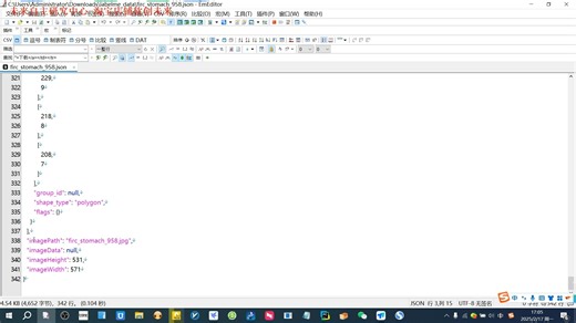 智慧医疗胃肠道息肉分割数据集labelme格式1000张1类别