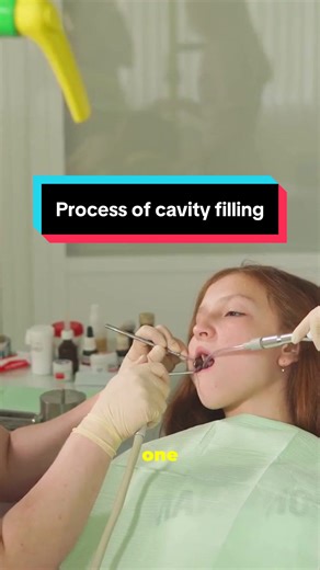 Simple steps to fill a cavity in tooth #teethcare #dentist #cavity
