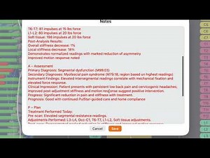 PulStar SOAP note generation using Apple Intelligence