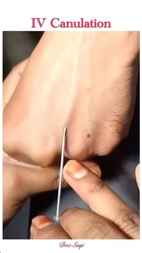 How to insert IV cannula |intravenous injection| #shorts #ivcannulation #ivinjection #intravenous