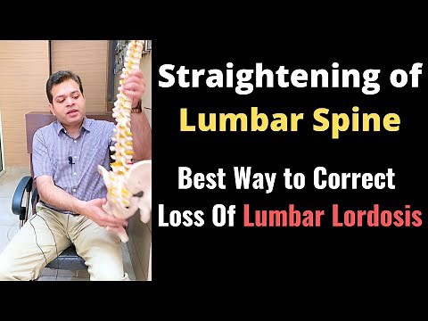 Straightening of Lumbar Spine, Loss of Lumbar Lordosis Treatment, How to Correct Lumbar Curvature