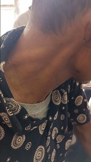 Elevated JVP|medicine classroom