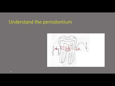 6 POINT POCKET CHART and RELATED PERIO TERMS: A NIGHTMARE? NOT ANYMORE