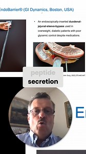 1.2K views | This video explains the hormonal changes and benefits associated with the EndoBarrier, focusing on improved glycemic control and weight loss. Watch the full lecture and explore our complete course library at EndoCollab.com. #gastroenterology #gastroenterologia #endoscopy #endoscopia #weightloss | EndoCollab | Facebook