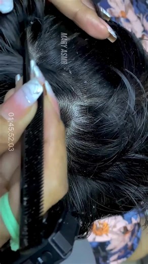 Quick Remove Dry Dandruff Flakes Scratching On The Scalp
