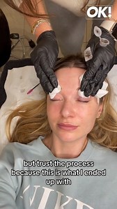 2.6K views · 15 reactions | OK! deputy style director Zoe puts her face to the test on new semi-permanent make-up techniques promising to subtly boost your features - from microblading to lip blushing ❤️ https://www.ok.co.uk/lifestyle/beauty/new-semipermanent-makeup-techniques-tattoo-30078117 | OK! Magazine UK | Facebook