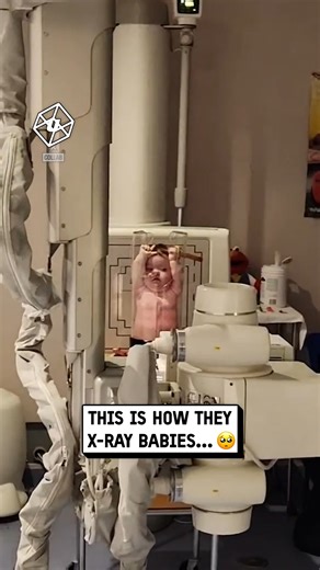 24M views · 101K reactions | Scan lasts just a few seconds 凉 | UNILAD | Facebook