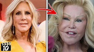 Top 10 Plastic Surgery Obsessed Celebrities That LOST Everything | Beyond The Screen