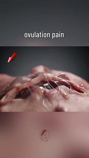 Understanding Ovulation Pain: Causes and Relief