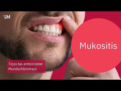 Mucositis: Tips for inflamed oral mucosa due to cancer therapy