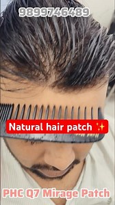 Best quality Premium Q7 Mirage Hair patch || 200% Natural Look patch || Hair Wigs For Mens Price