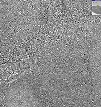 Shotgun Histology Lymph Node Reticulin Fibers