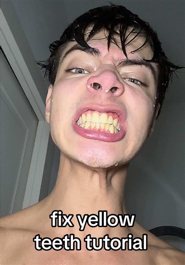 Effective Ways to Fix Yellow Teeth