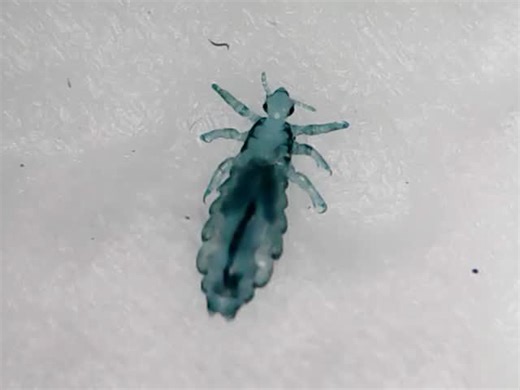 #headlicetreatment #nits #hair #headlice #reels #halloween #fyp #schoollife | Nit Nurse