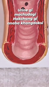 Urine test touthokse #fbviralpost2025シ #fbyシvideo #fblifestyle | S Memi Singha