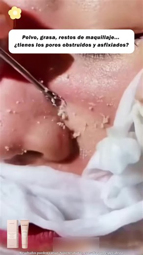 Si tienes la piel áspera, por favor mira esto. #hydrafacial #exfoliation #tiktokshop #Beauty #ProductReview #MustBuy #TikTokFinds #quarxery #skincare #glassskin #cleanpores #gel