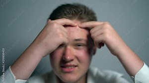 Young man squeezes the pimple on the face in front of the mirror. Closeup man's face with skin problems.