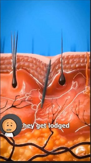 how splinter get unstuck animation explanation