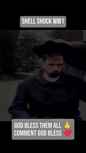 Exploring WW1 Shell Shock and Its Impact on History