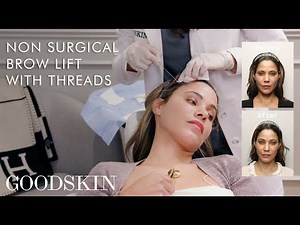 Non-Surgical Brow Lift with Threads — Inside The Treatment Room | GOODSKIN