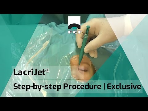 LacriJet® | Preloaded & Self-Retaining Monocanalicular Nasolacrimal Intubation | Surgical Procedure